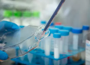 Cultura de celule in recipient medical