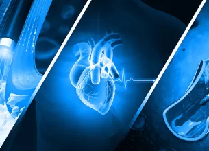 Ilustratie artere afectate de ateroscleroza si angioplastie cu stent