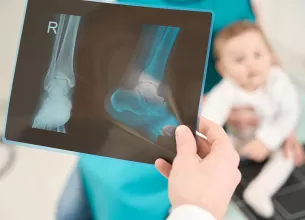 Specialist examineaza radiografia membrului inferior al unui copil