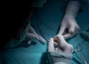 Chirurg vascular efectueaza o interventie minim invaziva asupra vaselor de sange
