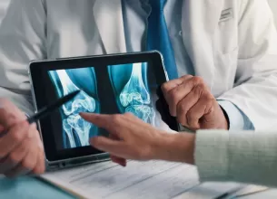 Medic analizeaza radiografia genunchiului pe o tableta