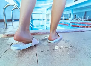 Persoana care poarta slapi la piscina pentru protectie impotriva infectiilor fungice