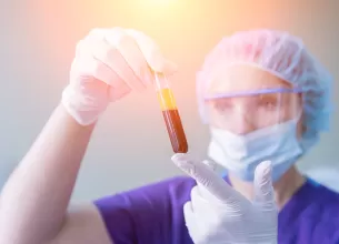Proba de plasma imbogatita cu trombocite pregatita pentru tratament regenerativ
