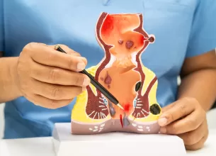 Medic care prezinta anatomia rectului