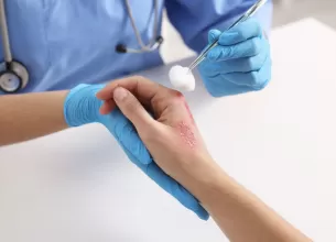 Medic trateaza o arsura la nivelul mainii in timpul unei consultatii medicale