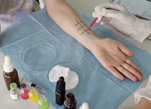 Test cutanat pentru alergii realizat pe brat cu solutii si marcaje colorate