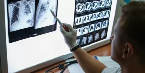 Riscul de cancer pulmonar poate fi redus cu 20 prin screening ct