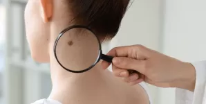 Medic examinand o alunita a unei femei cu lupa, in scop de depistare a cancerului de piele