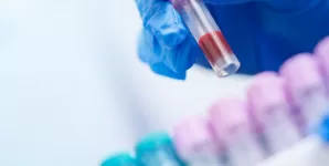 maini cu manusi tin proba de sange pentru analiza veterinara in laborator medical