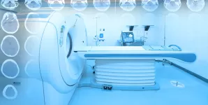 rmn si spectroscopia rm