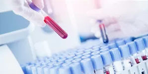 Medic specialist pregatind probe de sange pentru analize medicale.