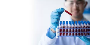 Tehnician tinand o eprubeta cu proba de sange pentru analiza in laborator.