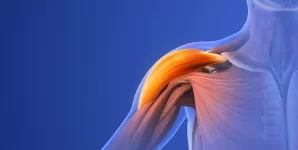 Ilustratie a unei leziuni la umar care provoaca durere musculara
