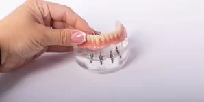 Implant dentar Fast&Fixed pe arcada mandibulara