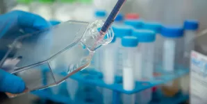 Cultura de celule in recipient medical