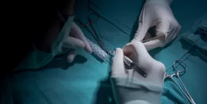 Chirurg vascular efectueaza o interventie minim invaziva asupra vaselor de sange