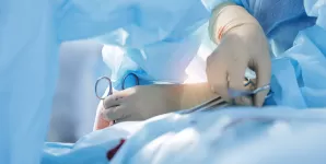 Echipa medicala realizeaza sutura unei incizii in timpul unei interventii chirurgicale abdominale