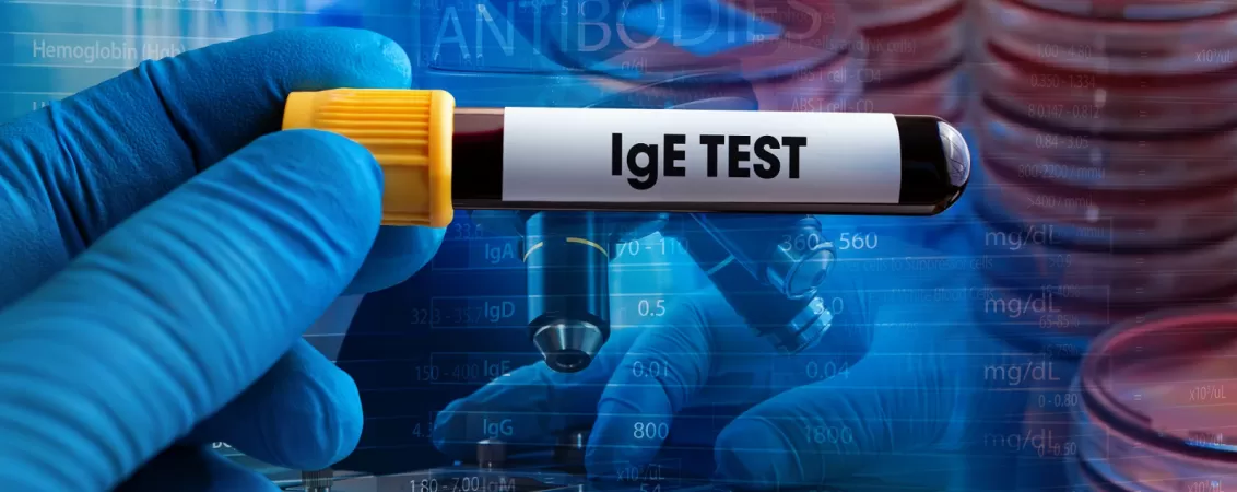 ce sunt anticorpii si care este rolul lor in organism