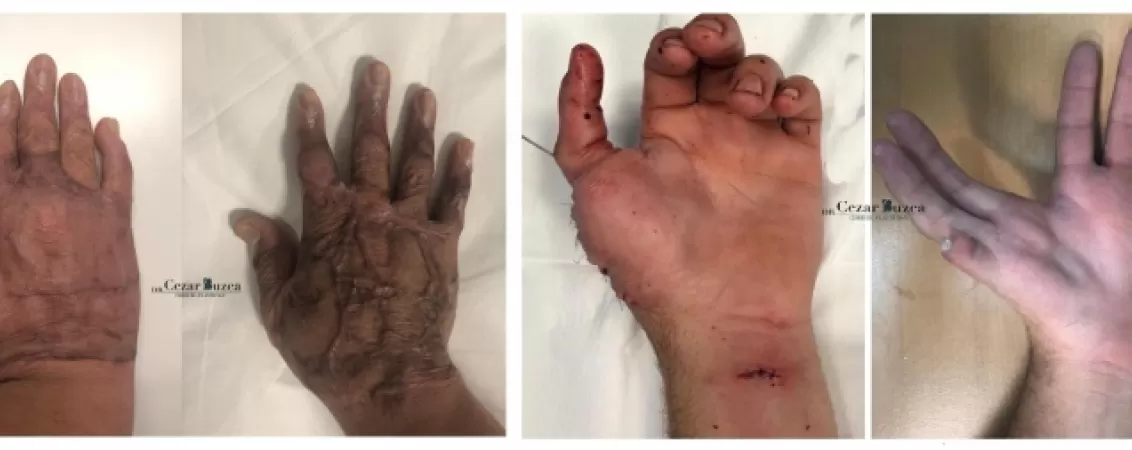 chirurgie moderna ce operatii pot fi realizate pentru corectarea unor defecte