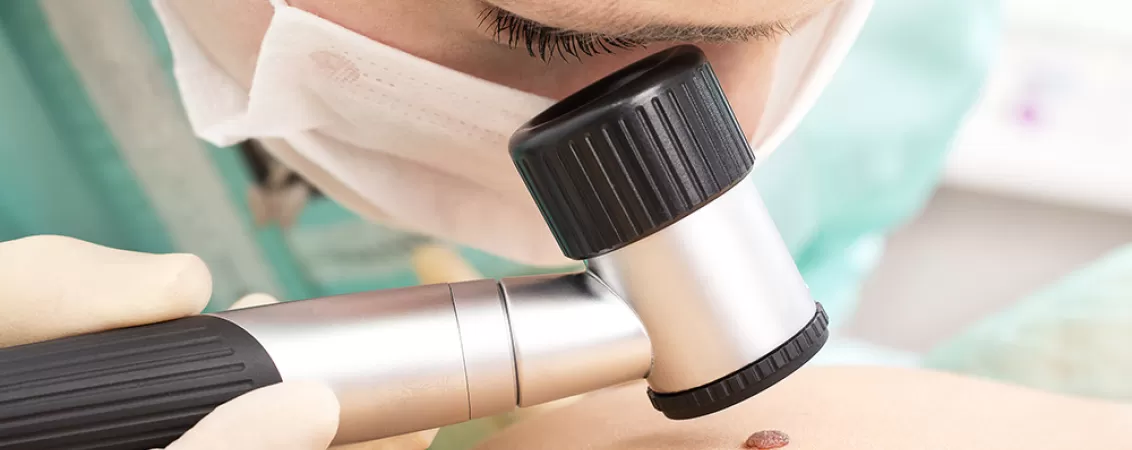 dermatoscopie ce este cand e recomandata importanta