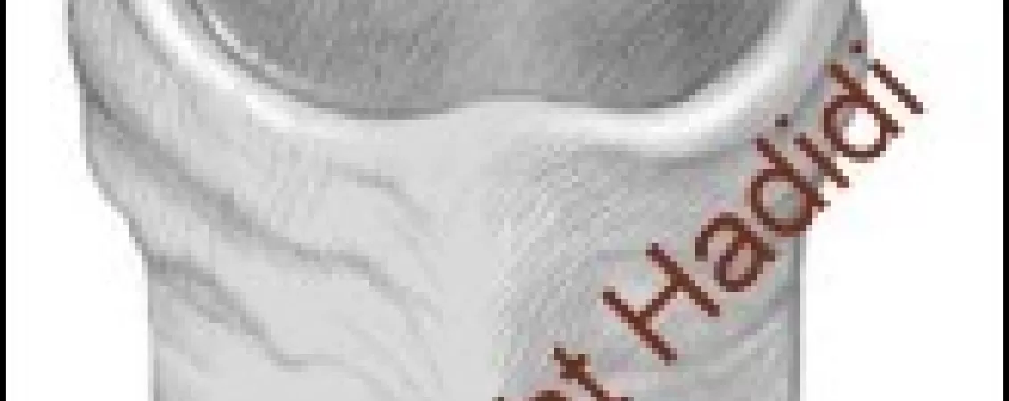 tratament chirurgical pentru hipospadias ce trebuie sa stii