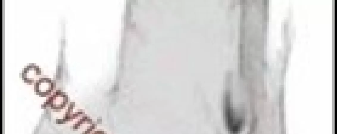 tratament chirurgical pentru hipospadias ce trebuie sa stii