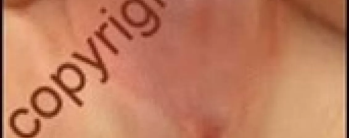 tratament chirurgical pentru hipospadias ce trebuie sa stii