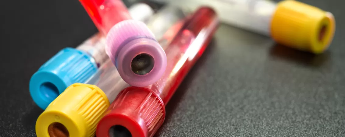 Instrumente pentru colectarea probelor de sange