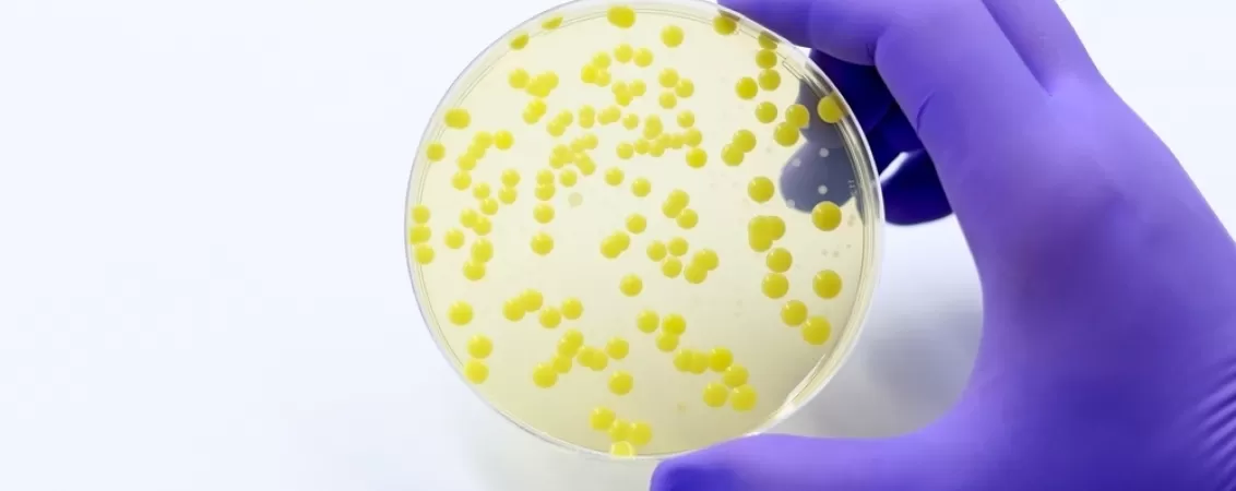 Proba de analliza a unei bacterii infectioase rezistente la antibiotic