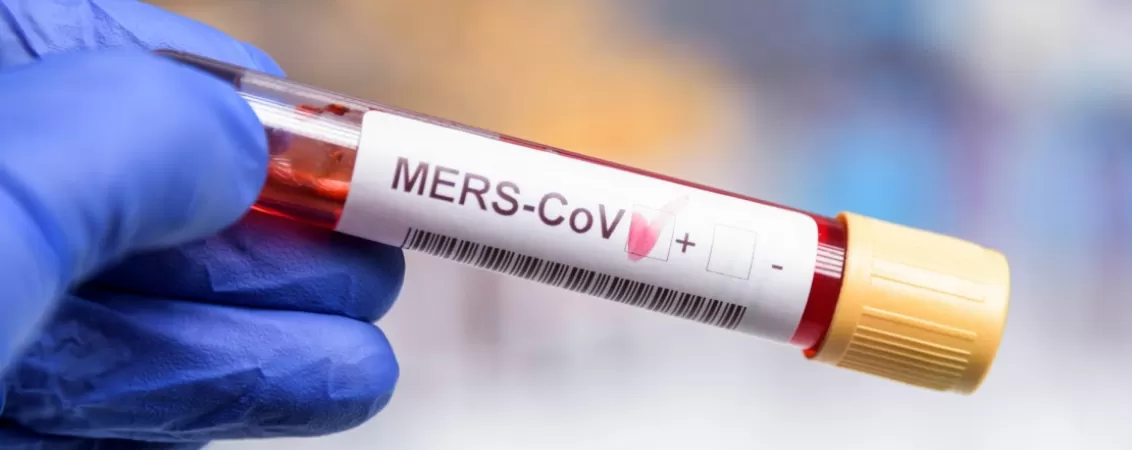 Eprubeta de laborator cu mostra testata pozitiv pentru infectia cu MERS-CoV, simbolizand diagnosticul si cercetarea bolilor infectioase