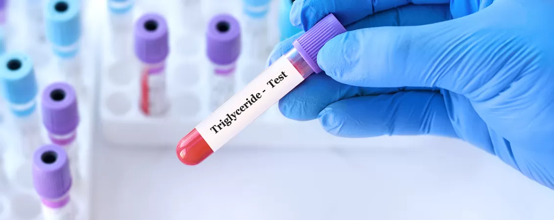 Doctor tinand un test pentru trigliceride