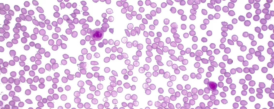 Hematii vazute la microscop