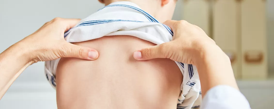 Medic examineaza spatele unui copil