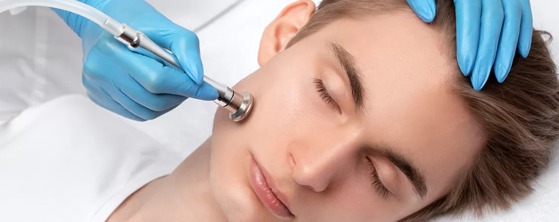 Microdermabraziune la un adolescent