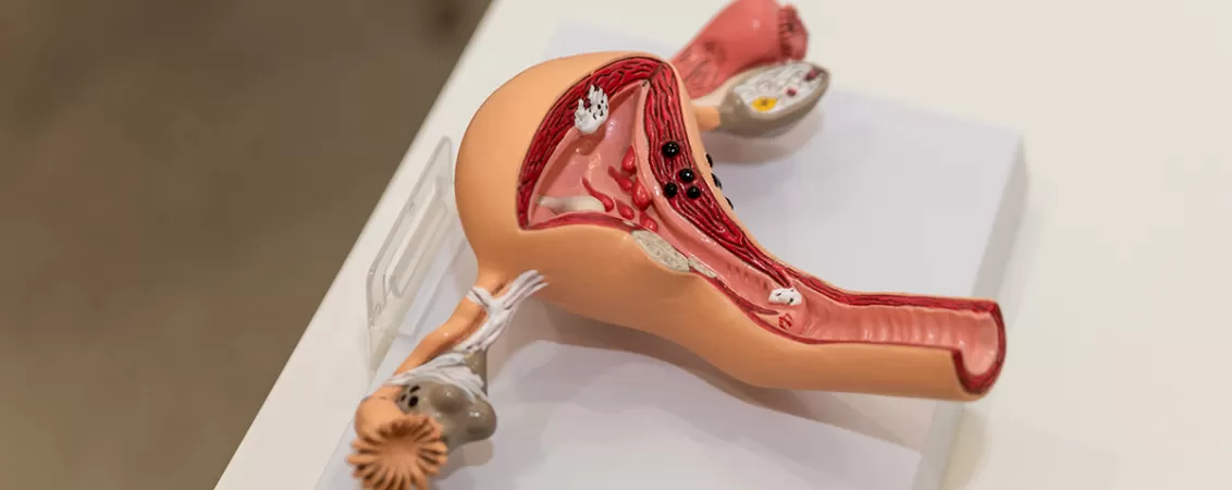 Model anatomic al uterului, trompelor uterine si ovarelor pe o masa