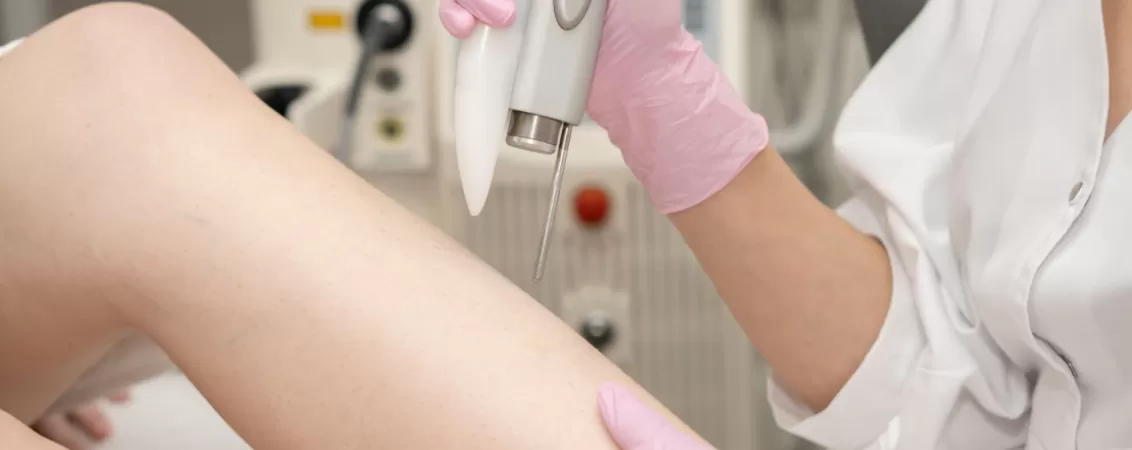 Epilare definitiva cu laser pe picioarele unei femei, in clinica de estetica medicala