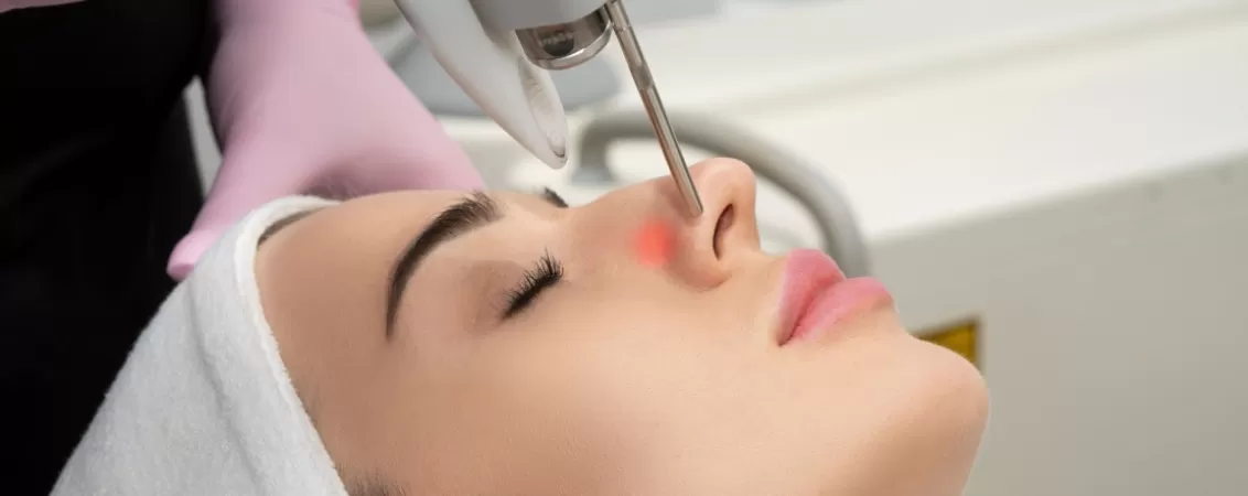 Procedura de indepartare a vaselor de sange sparte de pe nas cu ajutorul laserului, realizata in cabinet dermatologic