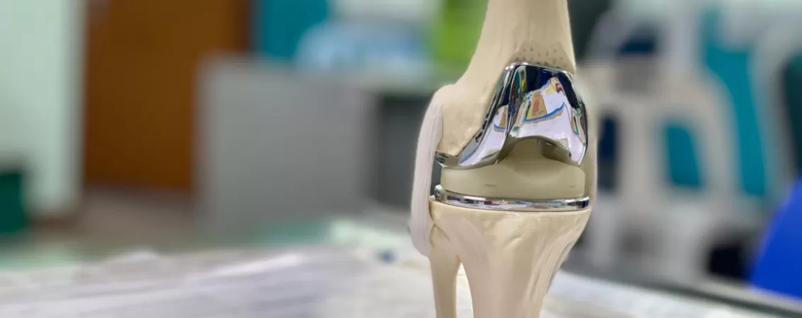 Proteza totala la genunchi, model anatomic