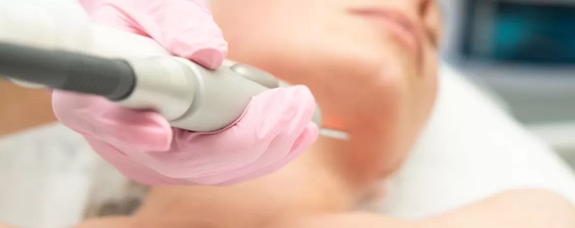 Rejuvenare dermica cu laser aplicata de un cosmetolog, tratament estetic pentru imbunatatirea aspectului pielii