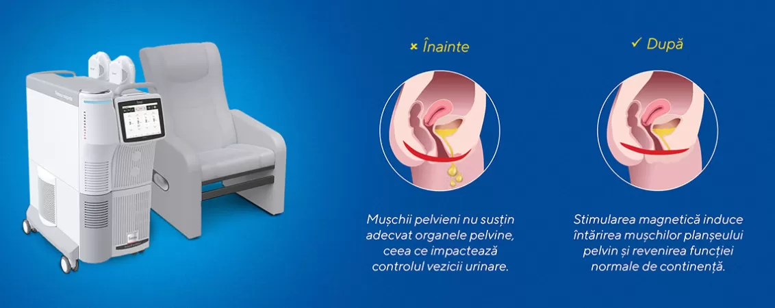 Ilustratie cu muschii pelvini inainte si dupa folosirea fotoliului magnetic