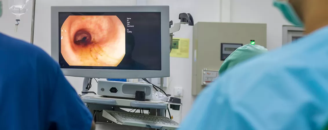 Medic efectuand o colonoscopie ca test de screening pentru cancerul colorectal