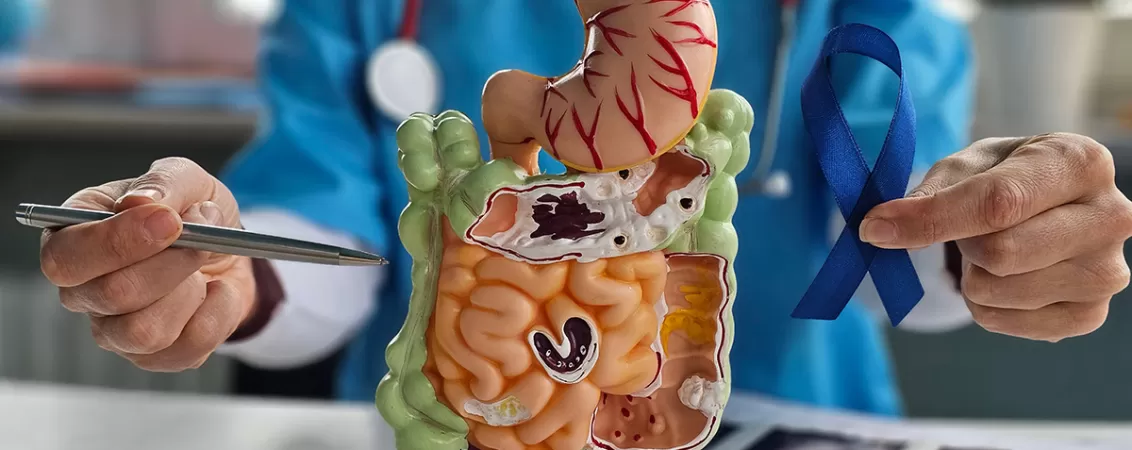Medic tinand o panglica albastru inchis, simbolizand cancerul colorectal, langa un model anatomic al colonului
