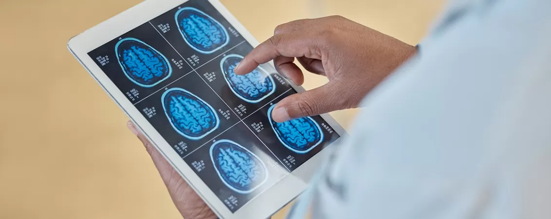 Doctor examinand o radiografie a creierului pe o tableta