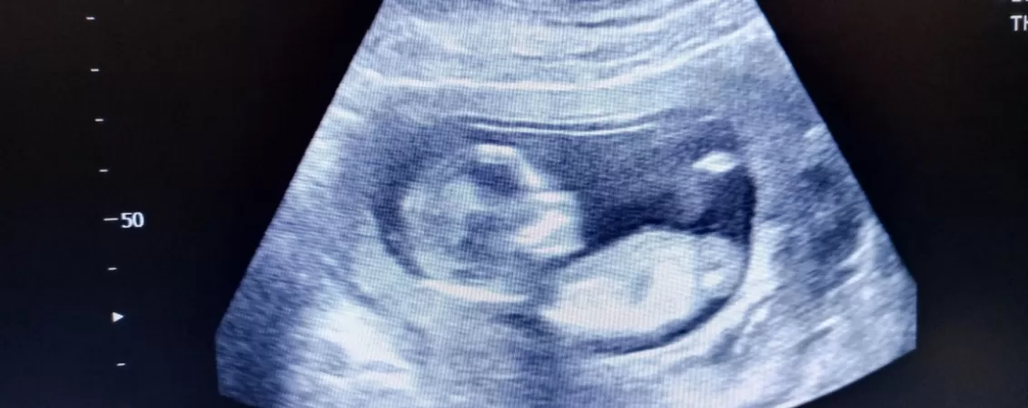 Ecografie cu fatul la 15 saptamani de sarcina, vizualizare detaliata a dezvoltarii fetale