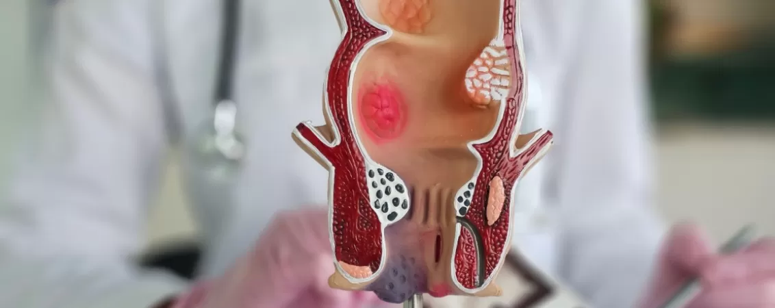 Model anatomic al rectului si anusului