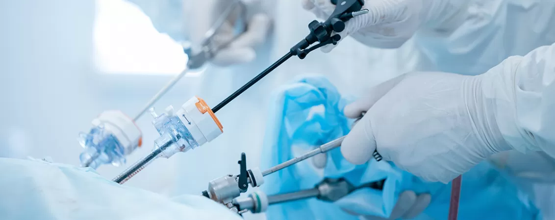 Chirurgi care efectueaza o operatie laparoscopica cu precizie in sala de operatie