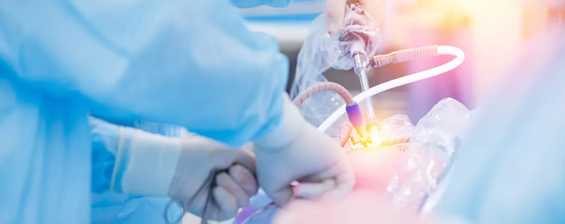 Medic care foloseste echipamente moderne pentru o operatie laparoscopica