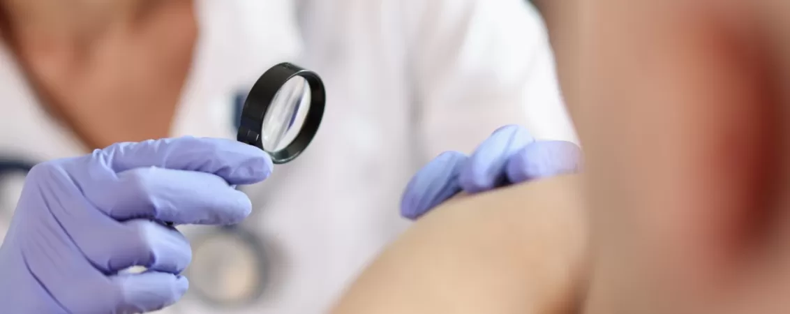 Medic dermatolog examinand pielea unui pacient cu lupa, verificand alunitele sau semnele de melanom