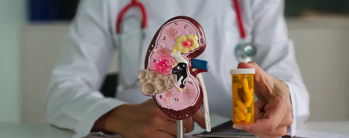 Medic tinand in mana un recipient cu antibiotice langa un model al rinichiului