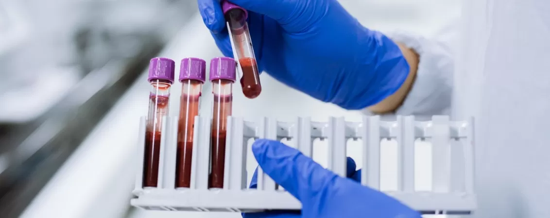 Probe de sange pentru analize pentru piele si par